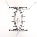 Labia Clamp Lips Pussy Spreader Bondage Kit I29258